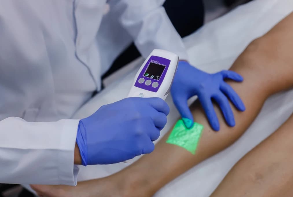 Técnicas com Criolaser e Crioescleroterapia