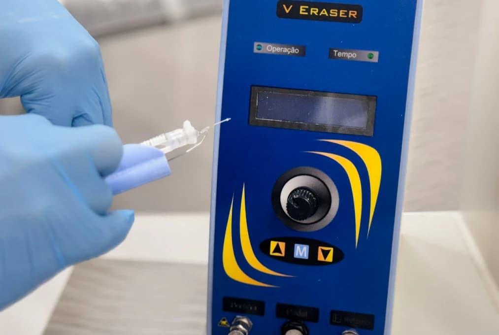 Radiofrequência Transdérmica