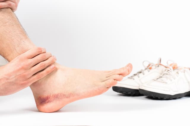 Tromboflebite migratória: o que pode indicar no corpo