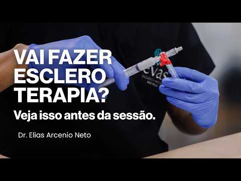 Espuma ecoguiada para varizes
