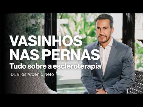 Escleroterapia para vasinhos