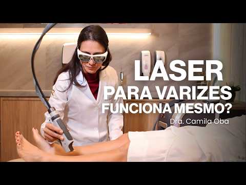 Tratamento a Laser para Varizes: funciona mesmo? | Dra. Camila Oba